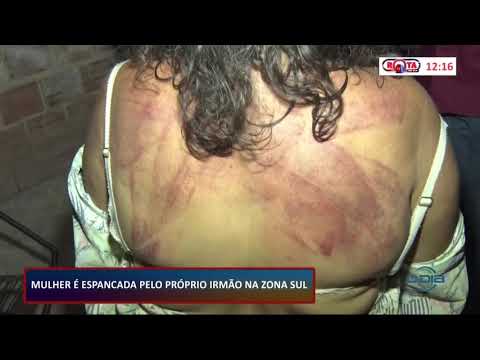 Mulher é espancada pelo próprio irmão embriagado na zona sul de Teresina 21 11 2020