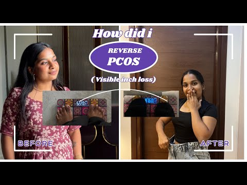 Soumya Sree and Akhil Jackson Vlogs