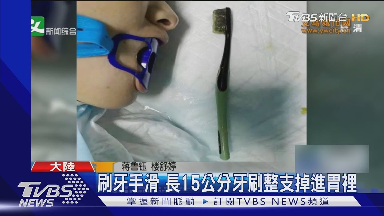 刷牙手滑 長15公分牙刷整支掉進胃裡