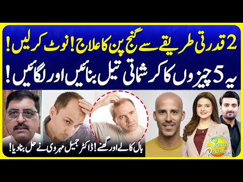 2 Natural Ways To Treat Baldness | Try This Magical Oil | Dr Jamil Mehravi | Suno Pakistan EP 685