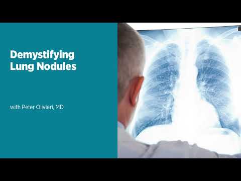Demystifying Lung Nodules