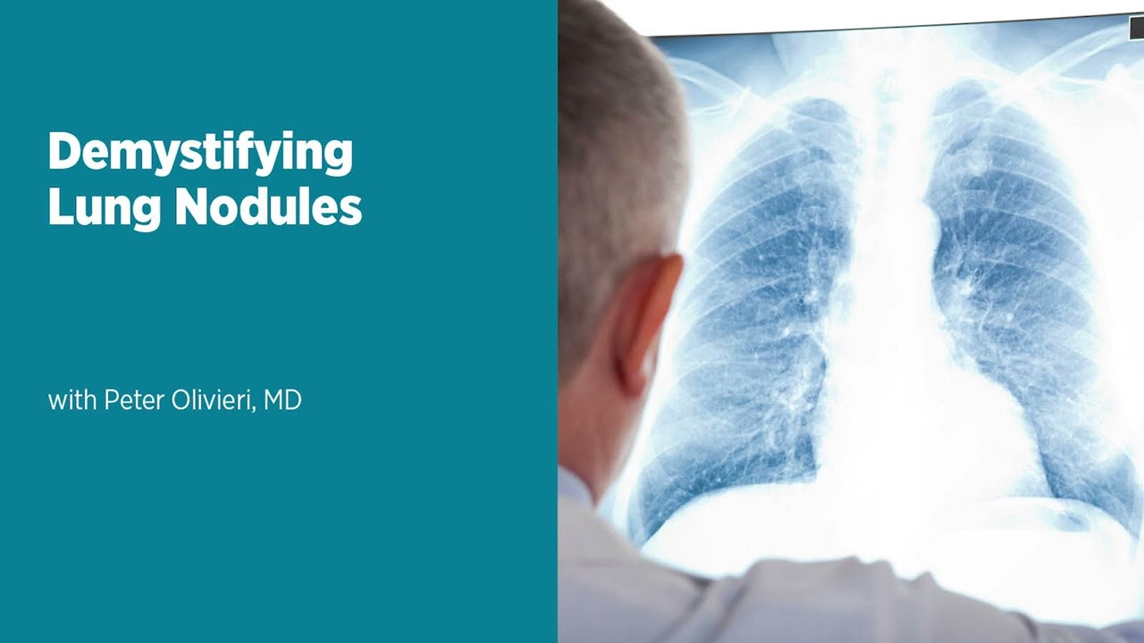 Demystifying Lung Nodules