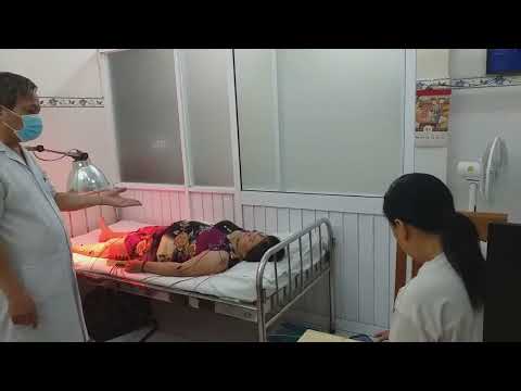 Thầy Hà Đức Dự đang châm cứu điện châm cho bệnh nhân nữ bị Di chứng TBMM não yếu liệt 1/2t, liệt thần kinh số VII ngoại biên, kèm nói khó, Huyết áp cao.