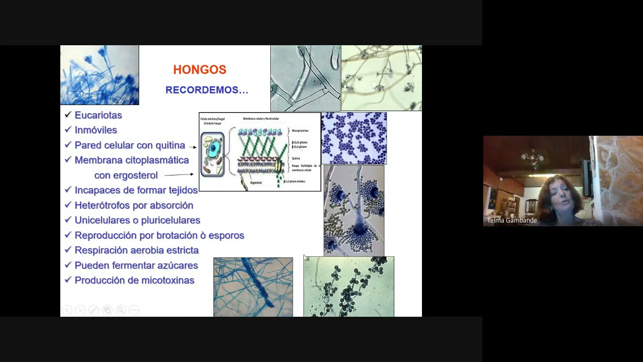 Quinto Seminario Microbiología Injuria 2021.Micosis Superficial, Oportunistas. Bacterias Anaerobias.