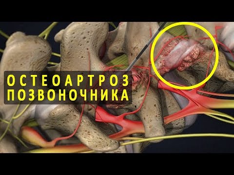 Признаки беременности на ранних сроках болит поясница Беременность боли в спине гимнастика