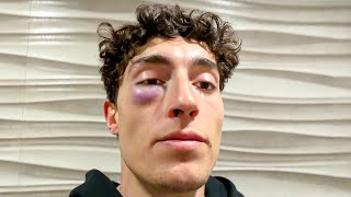 Thumbnail del capítulo