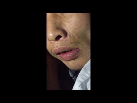 download lagu mp3 mp4 Orofacial, download lagu Orofacial gratis, unduh video klip Orofacial