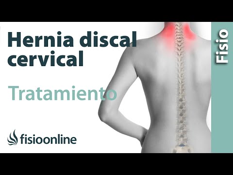 Dolor en la cadera y la espalda baja izquierda Los síntomas de la neuralgia de la columna cervical