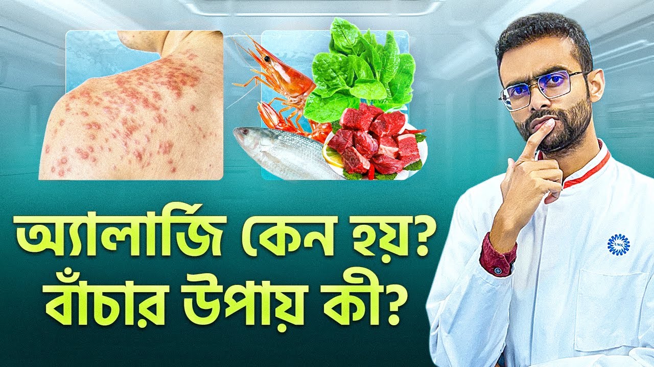 এলার্জি কেন হয় ও করণীয়