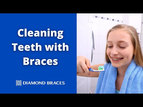 How to Clean Your Teeth with Braces: Essential Techniques