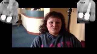 Dr. Sambhav Jain - Dental Implants Bay Area - Patient Testimonials