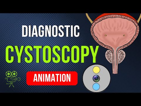 DIAGNOSTIC CYSTOSCOPY ANIMATION