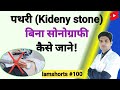 How To Know If You Have A Kidney Stone Without A Sonography Shorts Shortsvideo