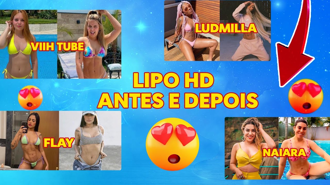 LIPO HD - Antes e depois I BBB21