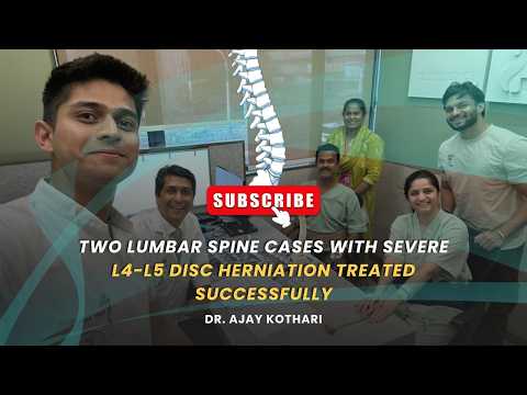 Two Lumbar Spine Cases With Severe L4-L5 Disc Herniation Treated Successfully | Dr. Ajay Kothari