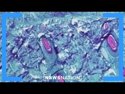 Health experts say cases of new COVID-19 variant are spiking | Morning in America