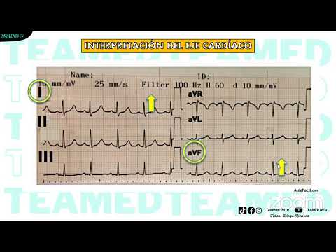 MEDICINA 2 | EKG NORMAL | REPASO GRATUITO