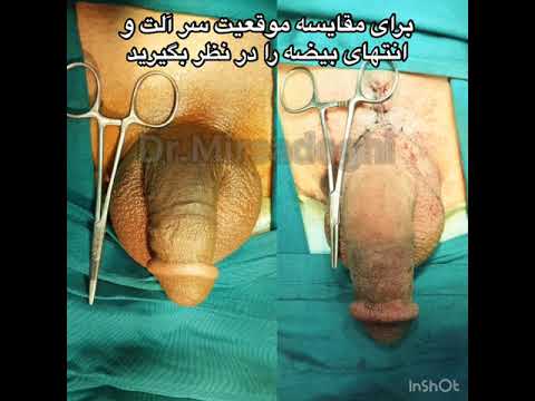 download lagu mp3 mp4 عکس الت, download lagu عکس الت gratis, unduh video klip عکس الت