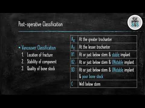 THA Periprosthetic Fractures