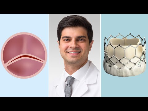 Bicuspid Aortic Valves: Surgical & Transcatheter Aortic Valve Replacement Options for Patients