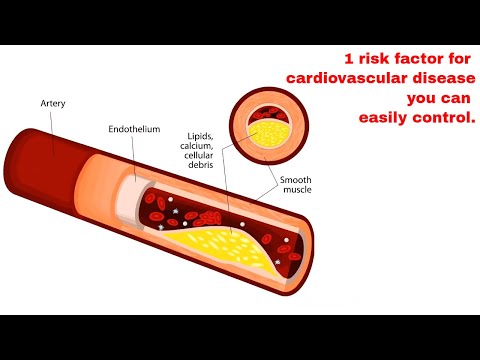 1 risk factor for cardiovascular disease you can easily control.