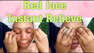 Calm Redness on face instantly|DIY Reduce skin redness, irritation& inflammation Naturally fast