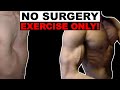 Pectus Excavatum Exercises Fix it Without Surgery! Pectus Excavatum Exercises Fix it Without Surgery!