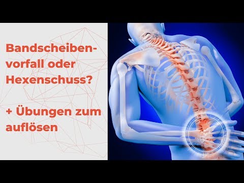 Bandscheibenvorfall oder Hexenschuss - was habe ich und wie werde ich es los + Übung für zu Hause