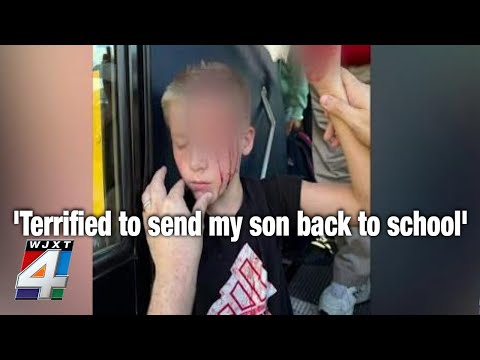 ‘Terrified to send my son back to school’: St. Johns County mom demands answers after son attacked