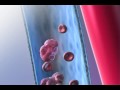 Pulmonary Embolism