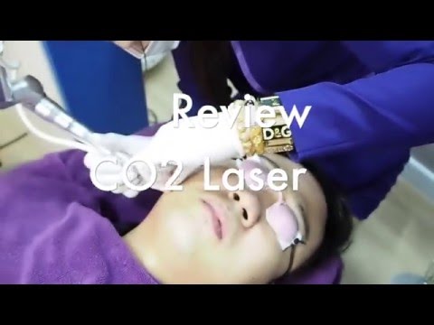 เต้านม mammoplasty หลังจาก 2 เดือน ว่าเสื้อผ้าที่จะรับกับหน้าอกเล็ก