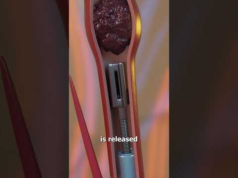 How The Milli-Spinner Works 😮