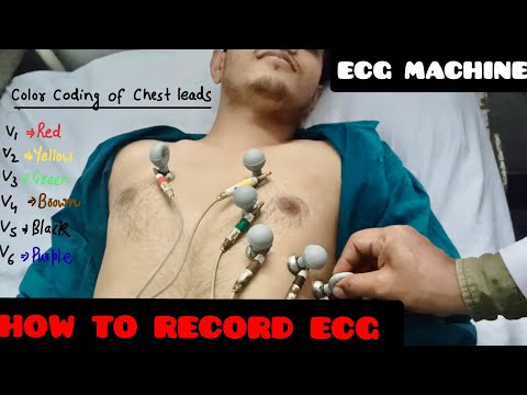 How To Record ECG | ECG leads Color Coding And Placement Location | ECG Machine