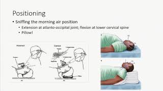 Airway Management in the Critically Ill Patient