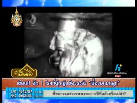 สินค้า LR จากโรคสะเก็ดเงิน Neurodermatitis การถือศีลอด