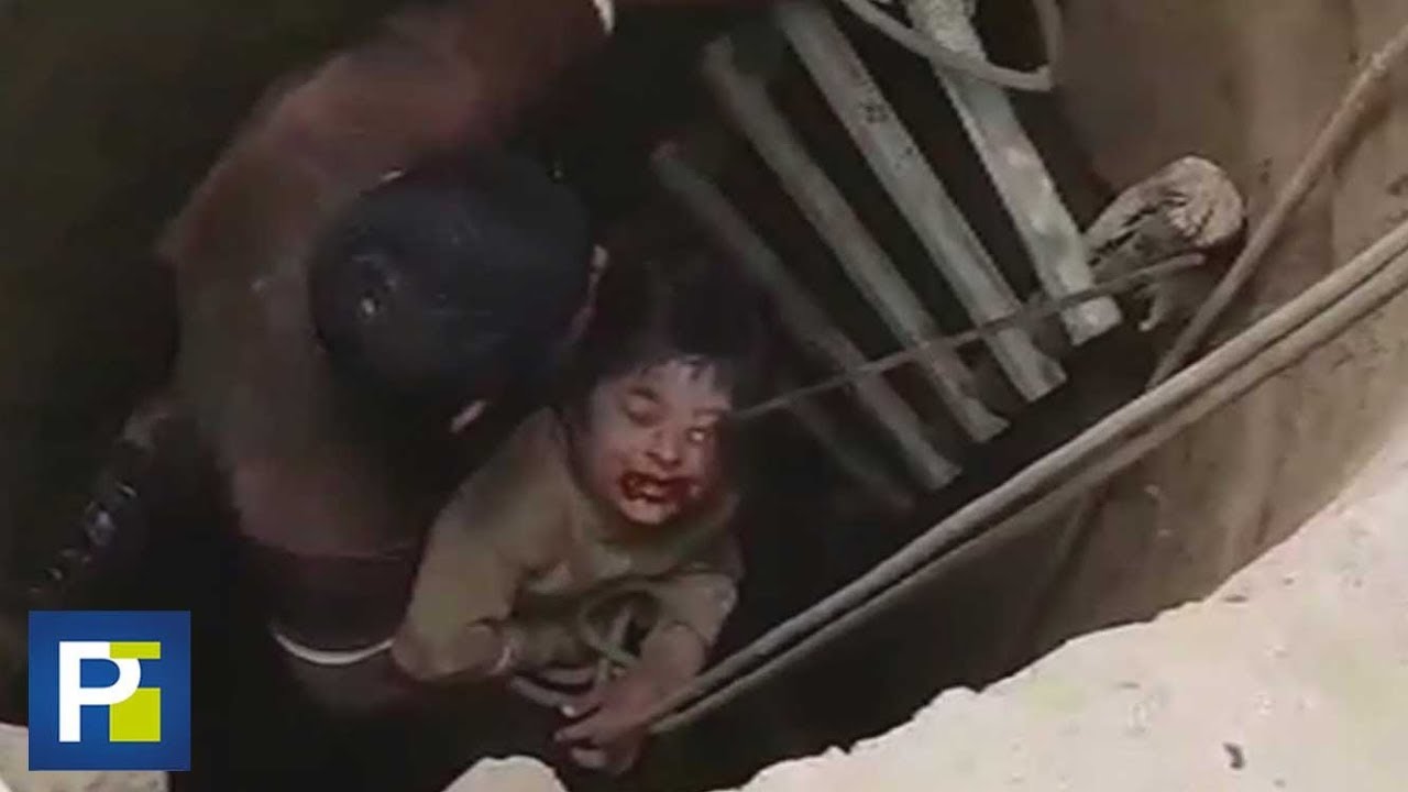 Imágenes del rescate de un niño que al caer a un pozo terminó con una barra incrustada en su cara