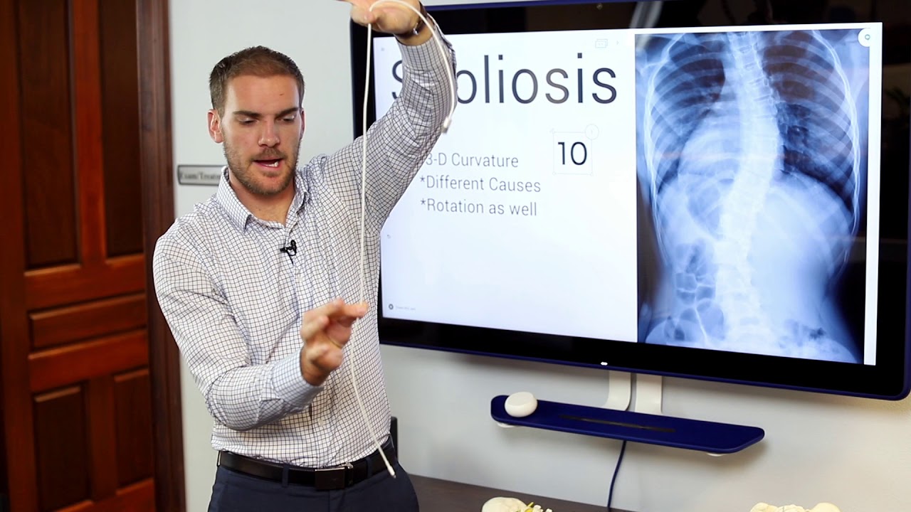 What is Scoliosis?