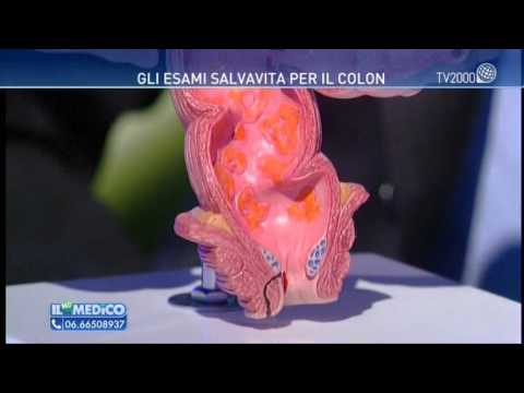 Articolazioni sclerosi droga Per via intramuscolare desametasone con il mal di schiena