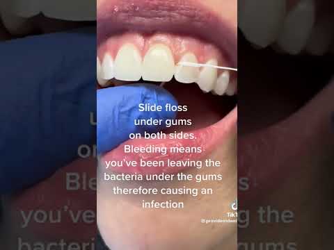 Are you flossing properly? #dentaltips #dentaleducation