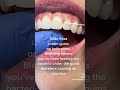 Are you flossing properly? #dentaltips #dentaleducation