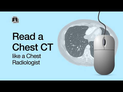 How to Read a Chest CT