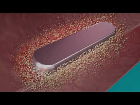 A new frontier in less invasive weight loss - The MagDI™ System.