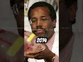 What Happened to Siamese Twins Ben Carson Separated Benjamin and Patrick Binder #shorts #history