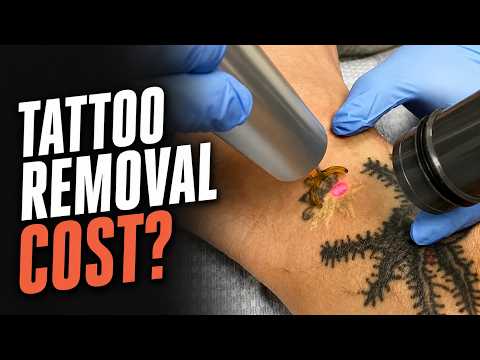 How Much Does Laser Tattoo Removal Cost? (Real Prices Explained)
