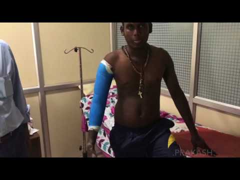 Video Of A New Orthopaedic Technique ; Extension Casting Of Humerous Diaphyseal Fractures
