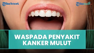 Apakah Kanker Mulut dapat Diobati, ini Jawaban drg Andi Tajrin M Kes, Sp, BM, K