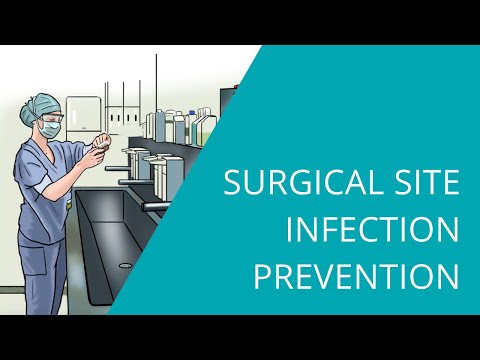 How to prevent surgical site infection