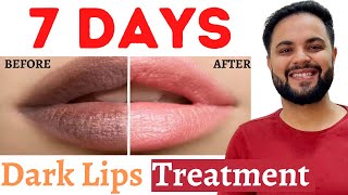 7 Days Dark Lips Removal Challenge || Pigmented Lips Treatment