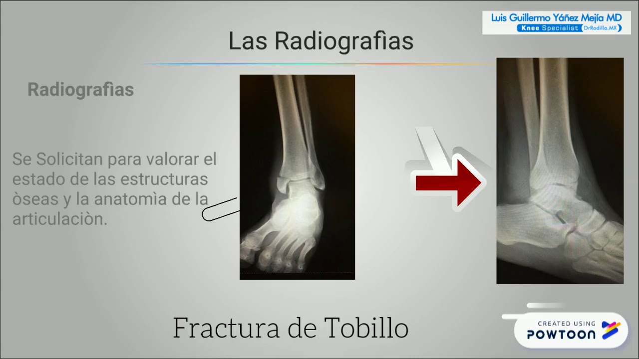 Luis Guillermo Yáñez Mejía-15