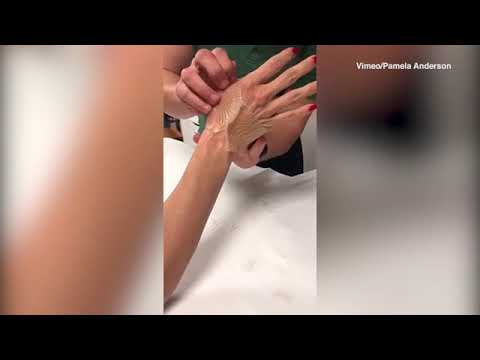 Les blessures de Pamela Anderson dont Adil Rami serait responsable